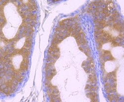 GOLPH3 Rabbit anti-Human, Mouse, Rat, Polyclonal, Novus Biologicals 100